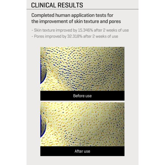 SOME BY MI, Retinol Intense Reactivating Serum 30ml - Picture 4 of 12